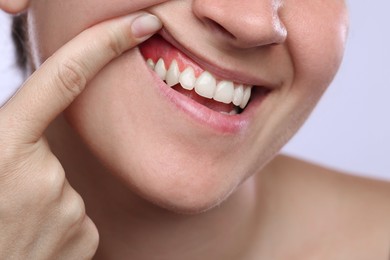 Image of Woman showing inflamed gum on light background, closeup
