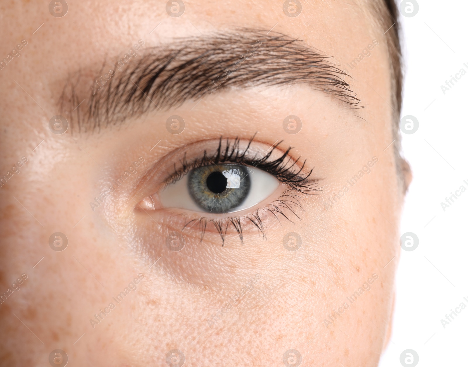 Woman before cosmetic procedure on white background, closeup Photo of Woman before cosmetic procedure on white background, closeup