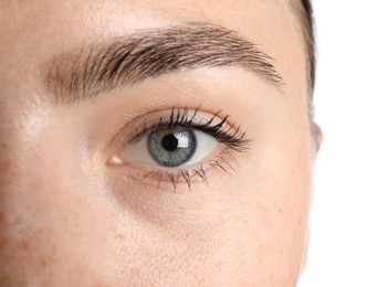 Photo of Woman before cosmetic procedure on white background, closeup