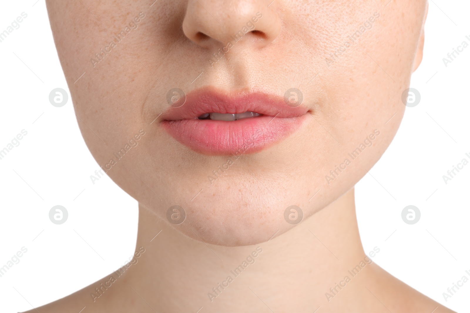 Woman before cosmetic procedure on white background, closeup Photo of Woman before cosmetic procedure on white background, closeup