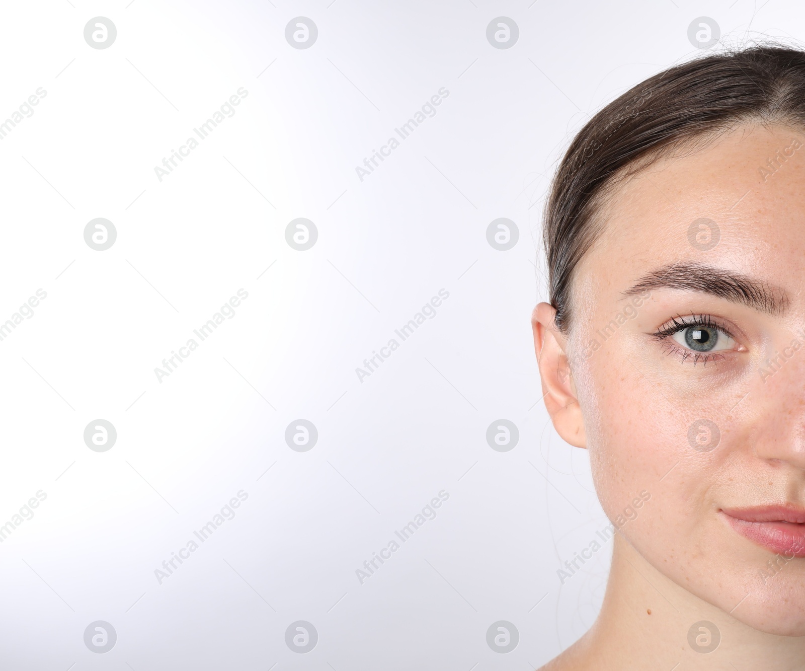 Photo of Woman before cosmetic procedure on white background, closeup. Space for text