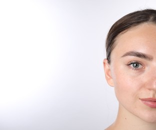 Photo of Woman before cosmetic procedure on white background, closeup. Space for text