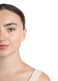 Photo of Woman before cosmetic procedure on white background, closeup