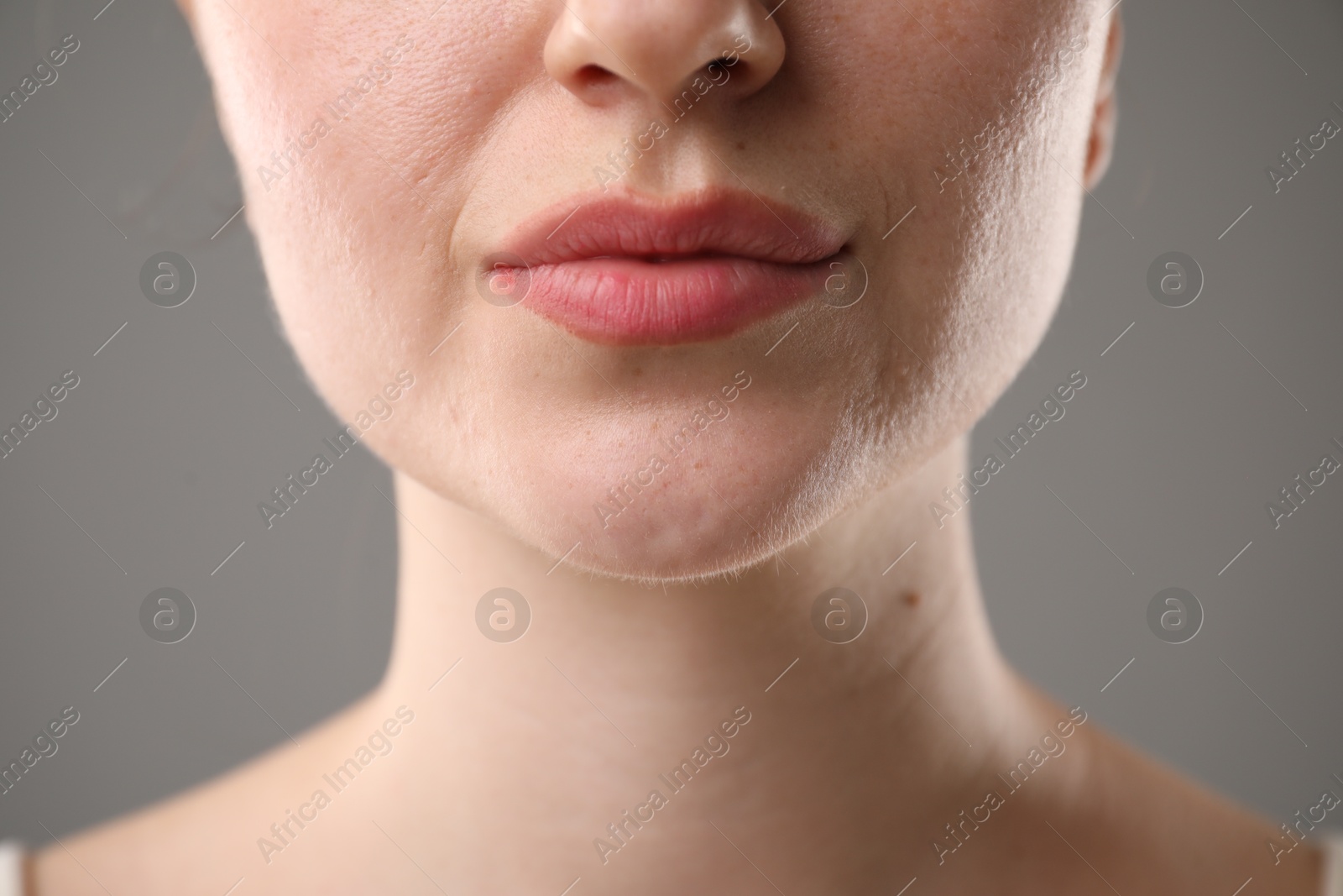 Photo of Woman before cosmetic procedure on grey background, closeup