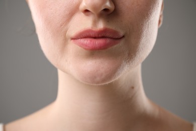 Photo of Woman before cosmetic procedure on grey background, closeup