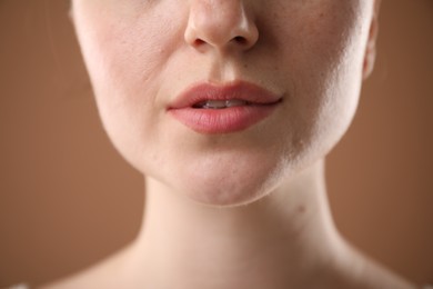 Photo of Woman before cosmetic procedure on brown background, closeup