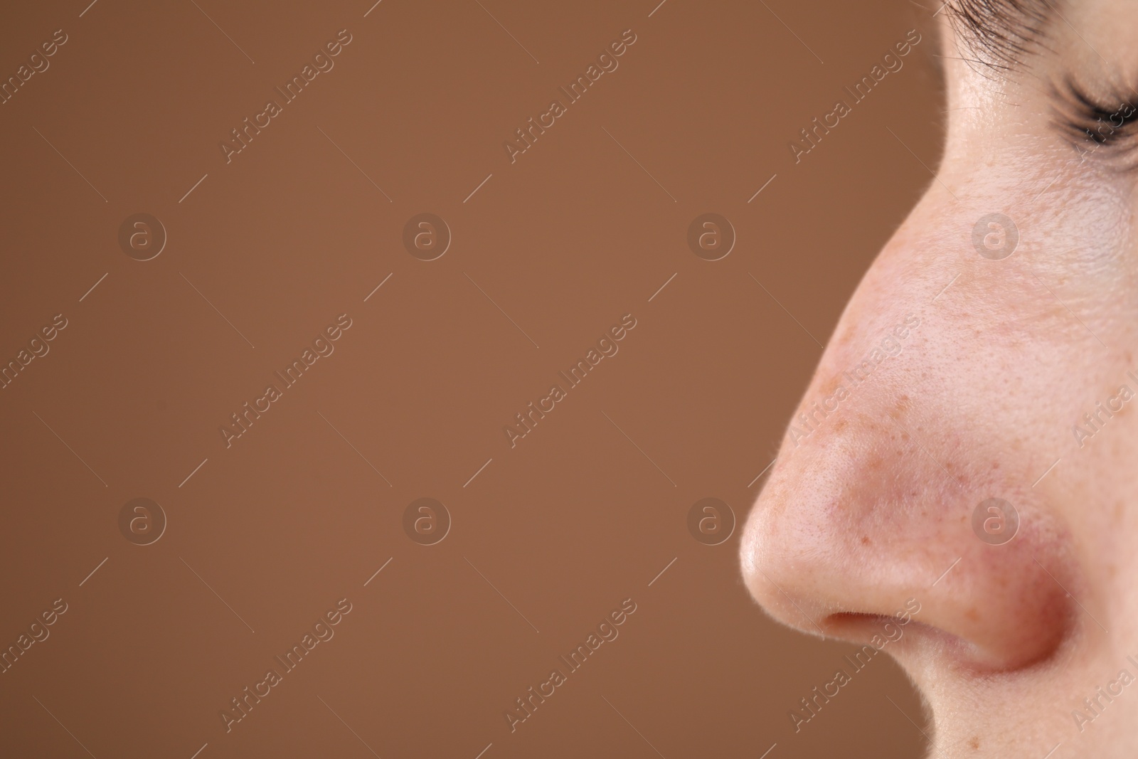 Woman before cosmetic procedure on brown background, closeup. Space for text Photo of Woman before cosmetic procedure on brown background, closeup. Space for text
