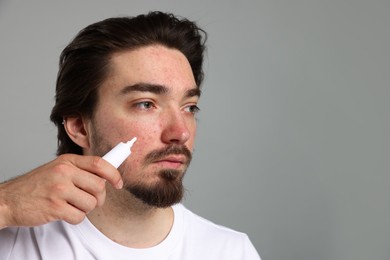Photo of Young man with acne problem applying cream onto his face on light grey background. Space for text