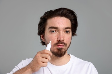 Photo of Young man with acne problem applying cream onto his face on light grey background