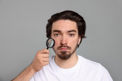 Photo of Young man with acne problem holding magnifying glass near his face on light grey background
