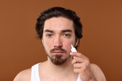 Photo of Young man with acne problem applying cream onto his face on brown background