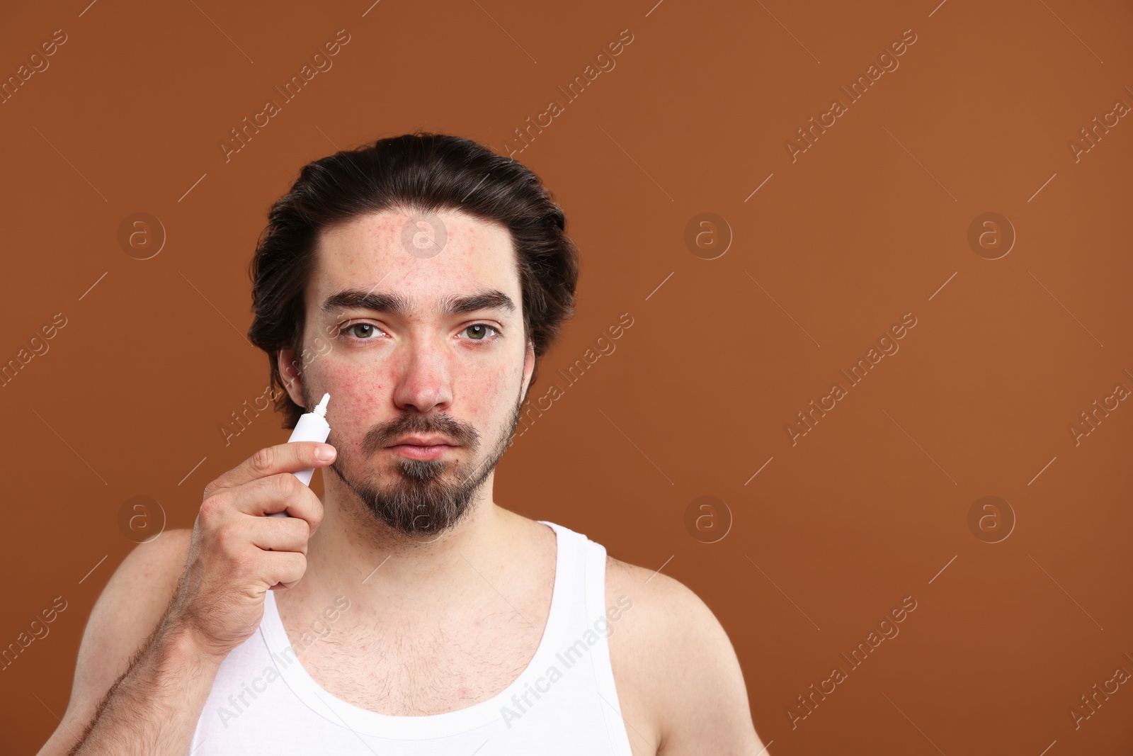 Young man with acne problem applying cream onto his face on brown background. Space for text Photo of Young man with acne problem applying cream onto his face on brown background. Space for text