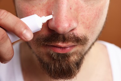 Photo of Young man with acne problem applying cream onto his face on brown background, closeup