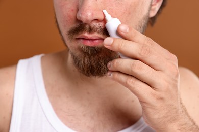 Photo of Young man with acne problem applying cream onto his face on brown background, closeup