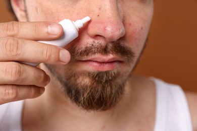 Photo of Young man with acne problem applying cream onto his face on brown background, closeup