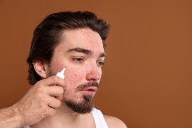 Photo of Young man with acne problem applying cream onto his face on brown background. Space for text