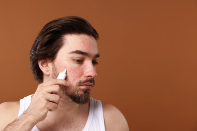 Photo of Young man with acne problem applying cream onto his face on brown background. Space for text