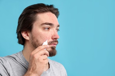 Photo of Young man with acne problem applying cream onto his face on light blue background, space for text