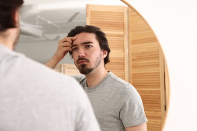Photo of Young man with acne problem near mirror at home