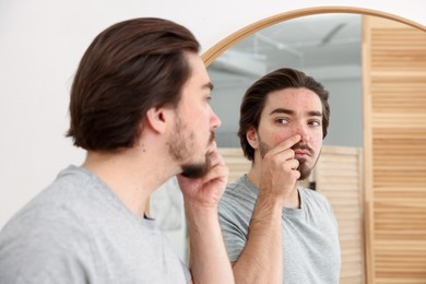 Photo of Young man with acne problem near mirror at home