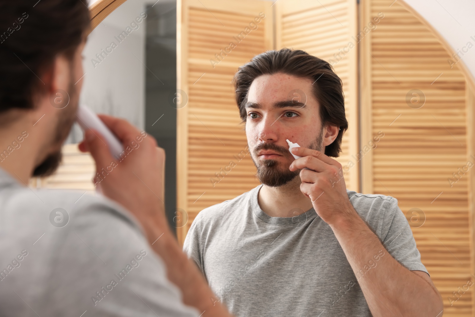 Young man with acne problem applying cream onto his face near mirror at home Photo of Young man with acne problem applying cream onto his face near mirror at home