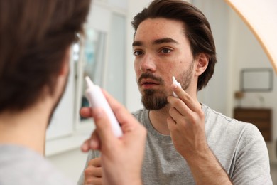 Photo of Young man with acne problem applying cream onto his face near mirror at home