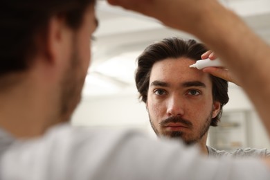Photo of Young man with acne problem applying cream onto his face near mirror at home