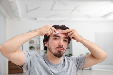 Photo of Young man with acne problem applying cream onto his face at home
