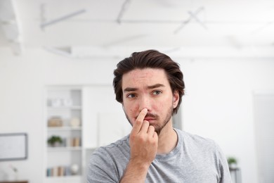 Photo of Young man with acne problem at home. Space for text