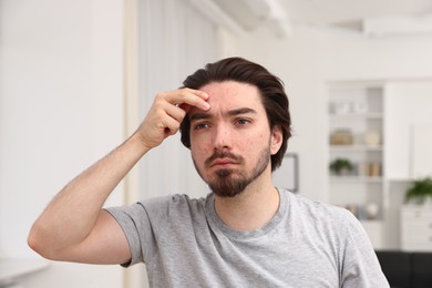 Photo of Young man with acne problem at home