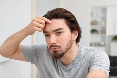 Photo of Young man with acne problem at home