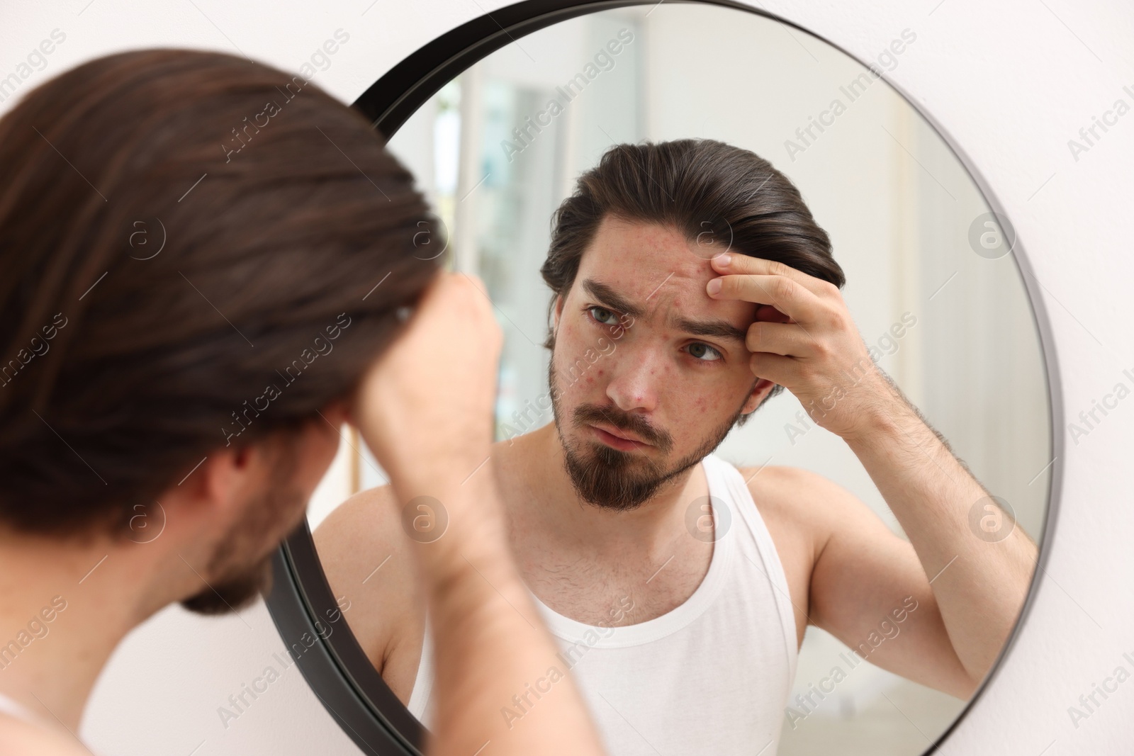 Young man with acne problem near mirror at home Photo of Young man with acne problem near mirror at home
