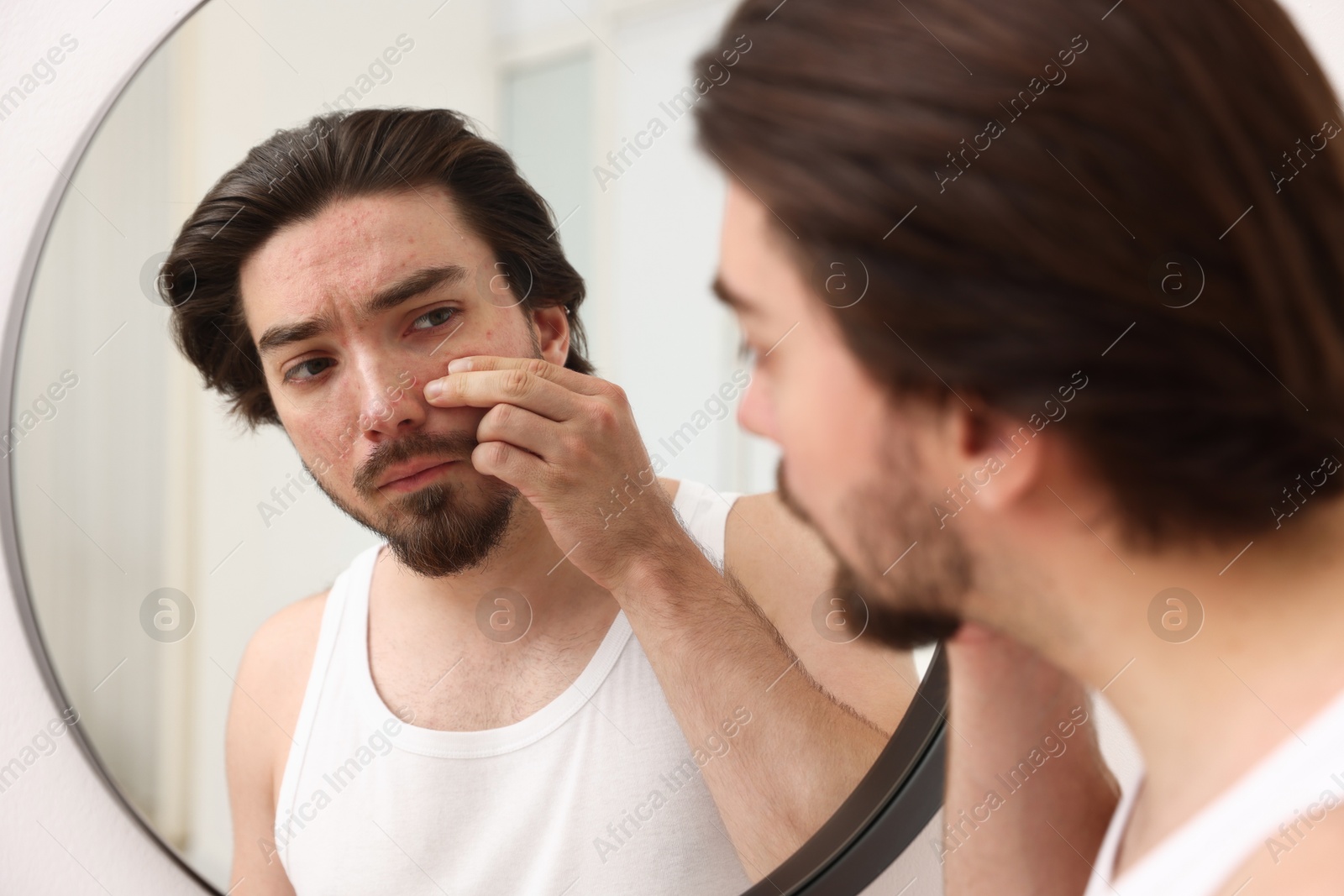 Young man with acne problem near mirror at home Photo of Young man with acne problem near mirror at home