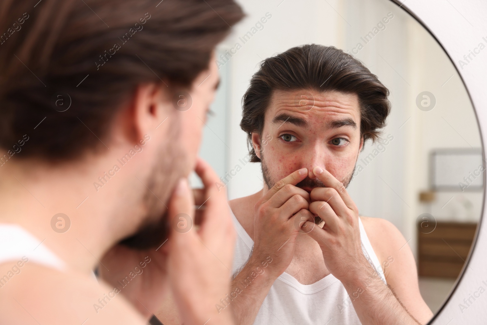 Young man with acne problem near mirror at home Photo of Young man with acne problem near mirror at home