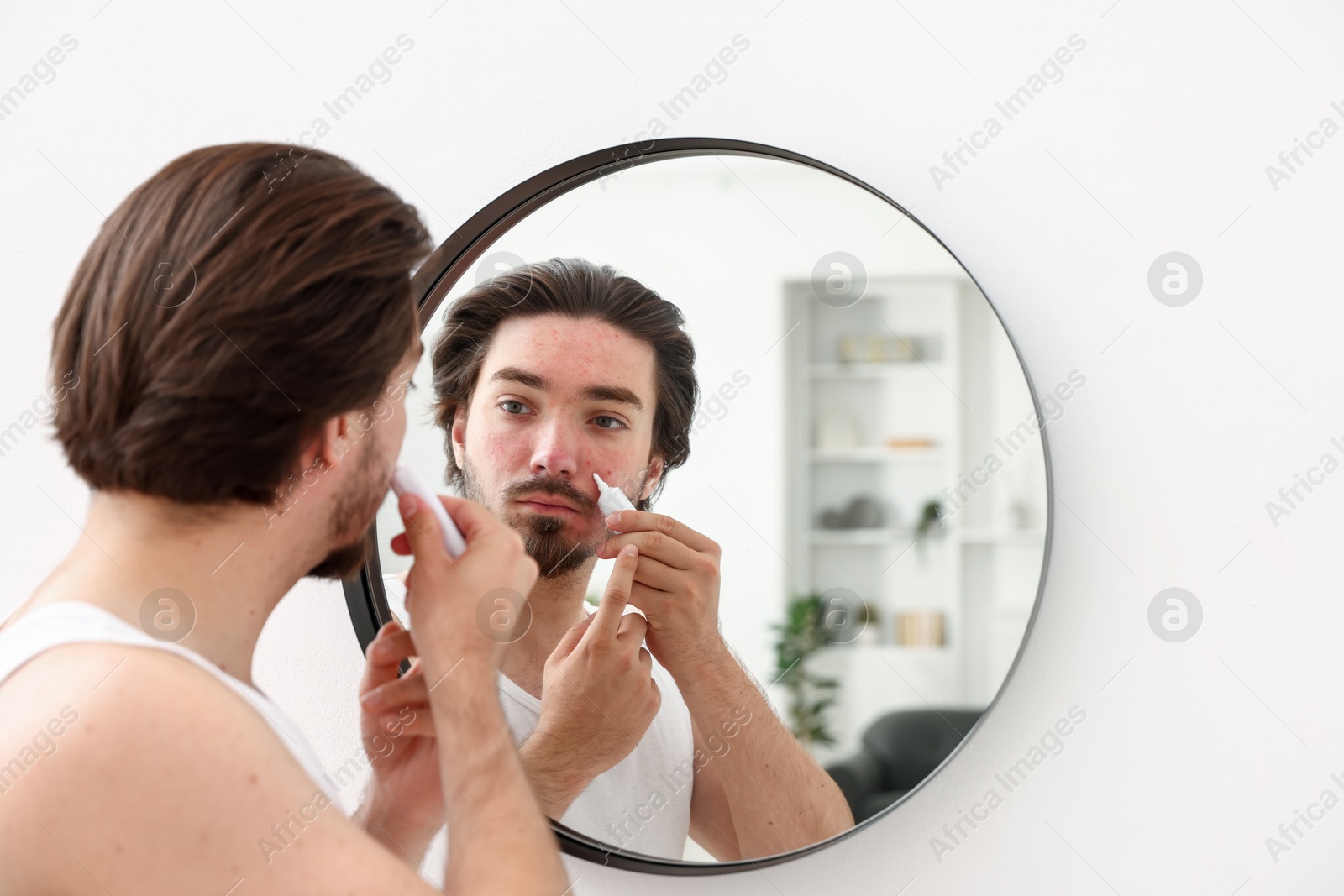 Young man with acne problem applying cream onto his face near mirror at home Photo of Young man with acne problem applying cream onto his face near mirror at home