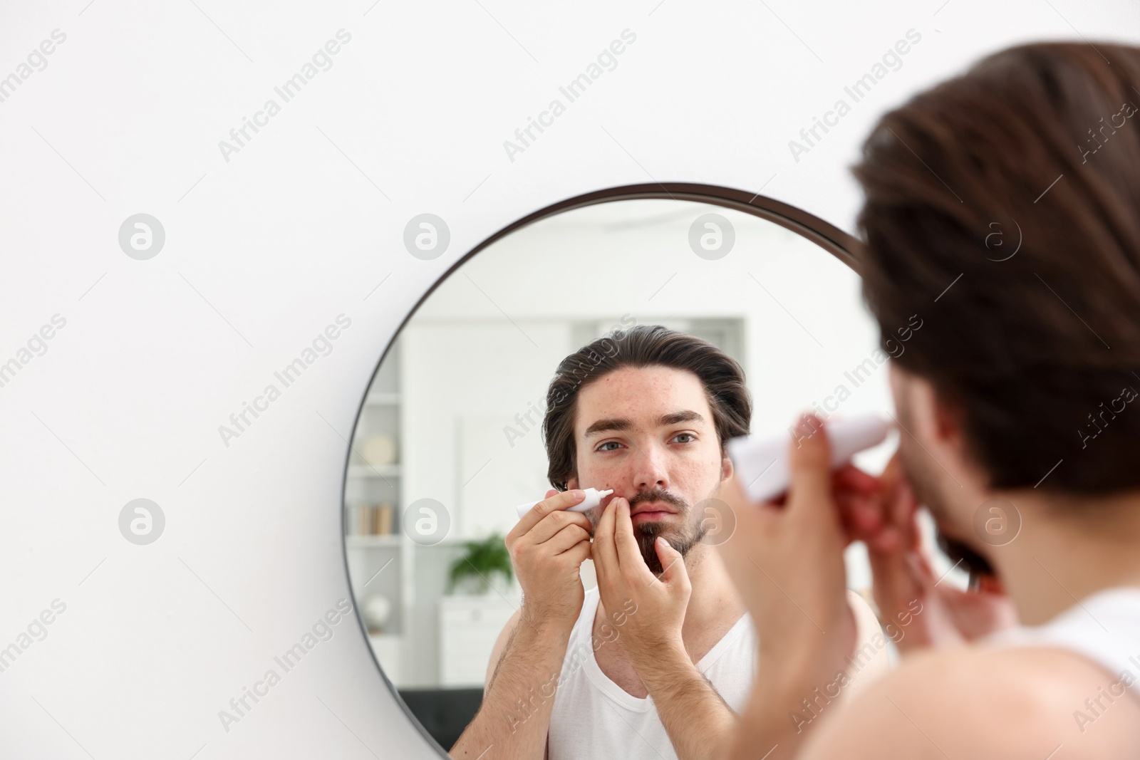Young man with acne problem applying cream onto his face near mirror at home, space for text Photo of Young man with acne problem applying cream onto his face near mirror at home, space for text