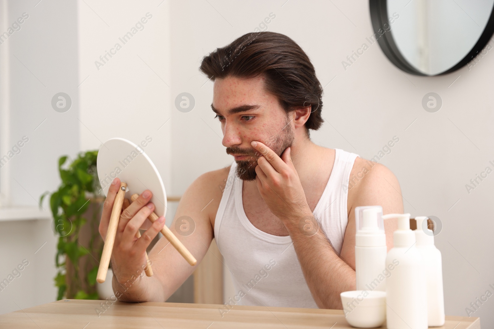 Young man with acne problem looking at mirror at table indoors Photo of Young man with acne problem looking at mirror at table indoors