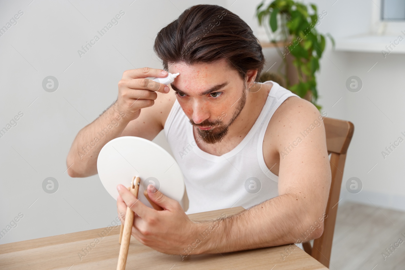 Young man with acne problem applying cream onto his face near mirror at table indoors Photo of Young man with acne problem applying cream onto his face near mirror at table indoors
