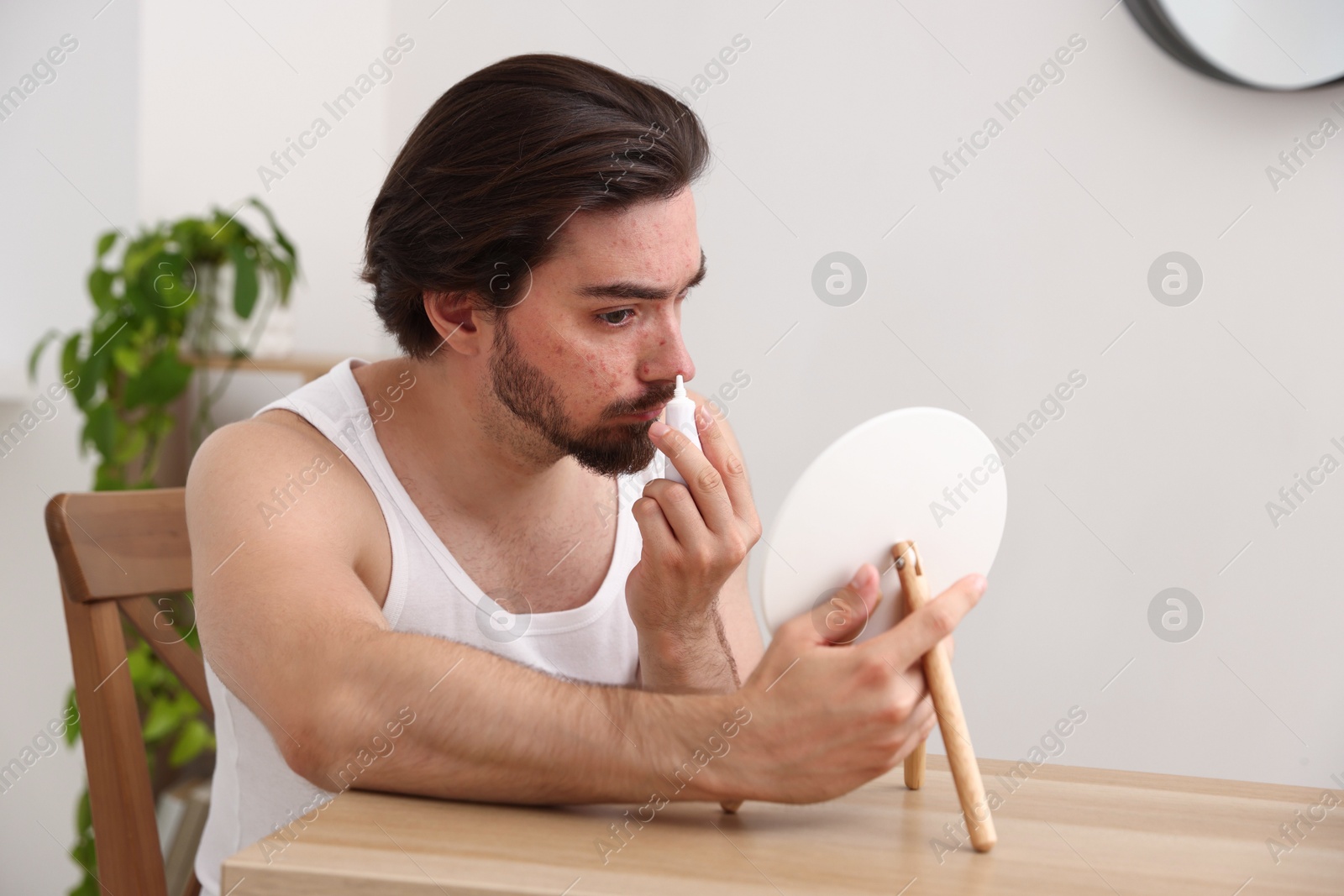 Young man with acne problem applying cream onto his face near mirror at table indoors Photo of Young man with acne problem applying cream onto his face near mirror at table indoors