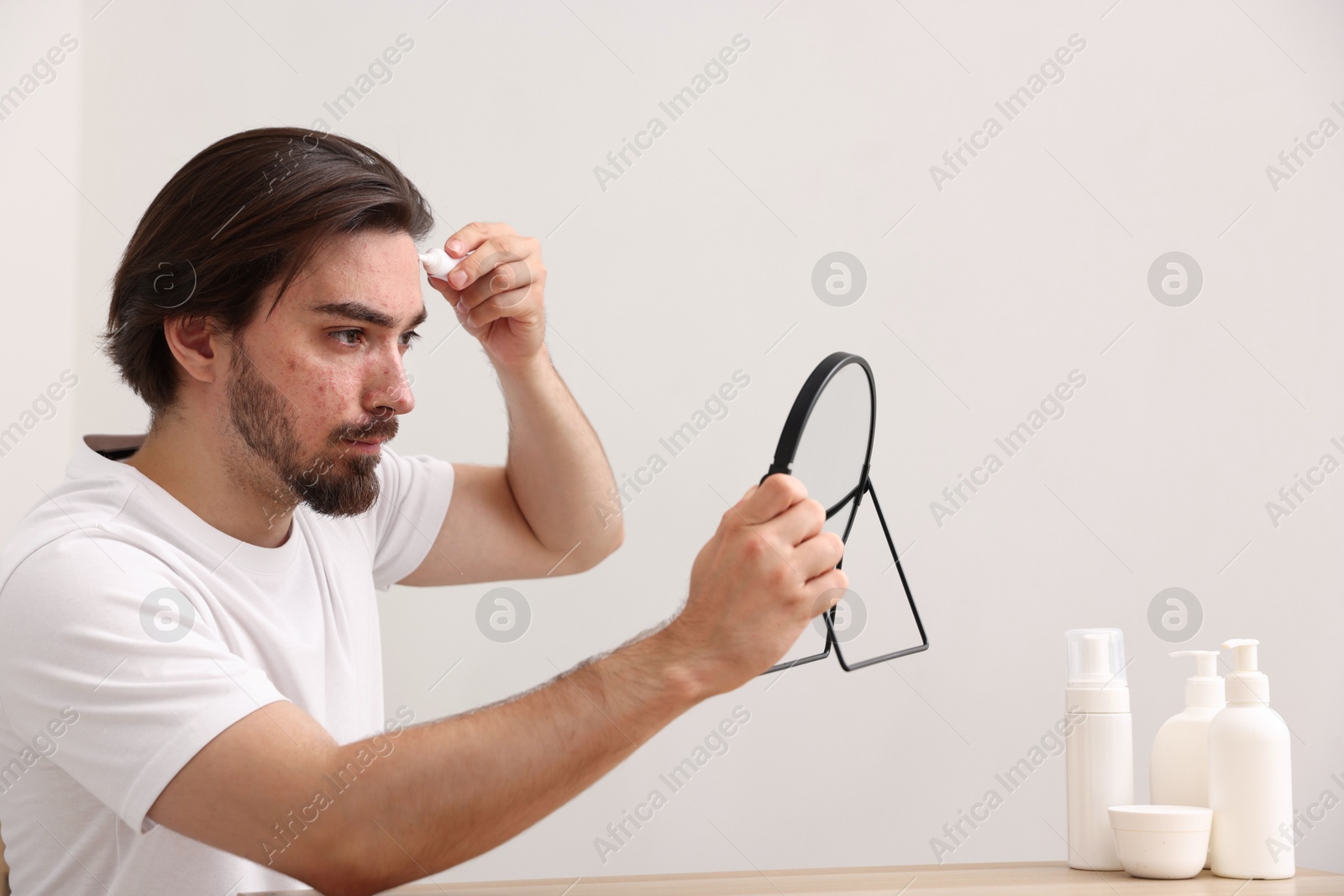 Young man with acne problem applying cream onto his face near mirror at table indoors Photo of Young man with acne problem applying cream onto his face near mirror at table indoors