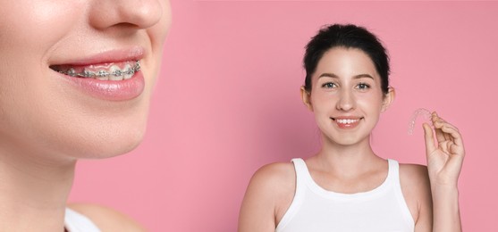 Image of Woman showing perfect teeth as result of using dental braces on pink background, closeup. Collage with before and after photos