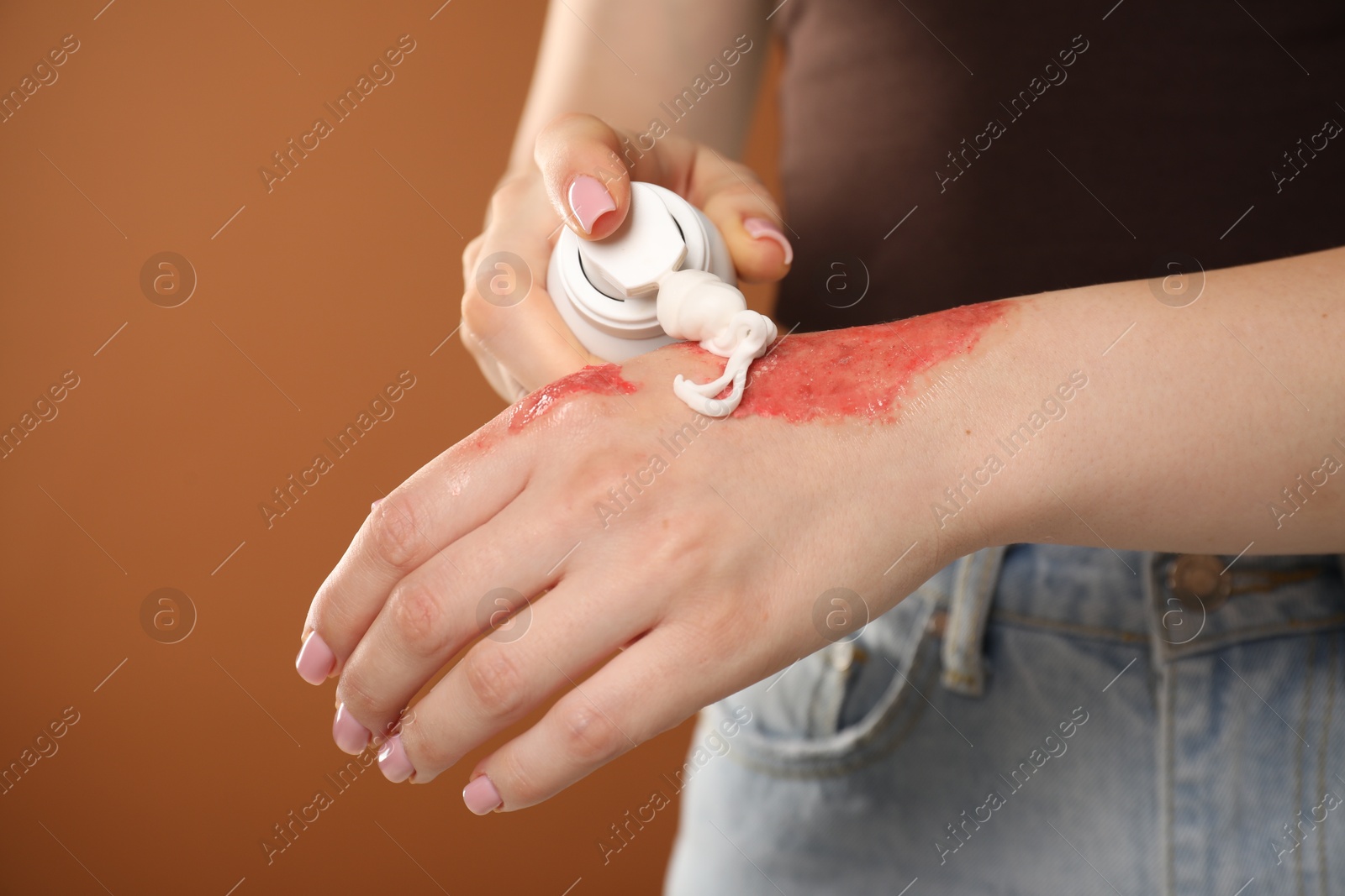 Woman applying healing cream onto burned hand on brown background, closeup Photo of Woman applying healing cream onto burned hand on brown background, closeup