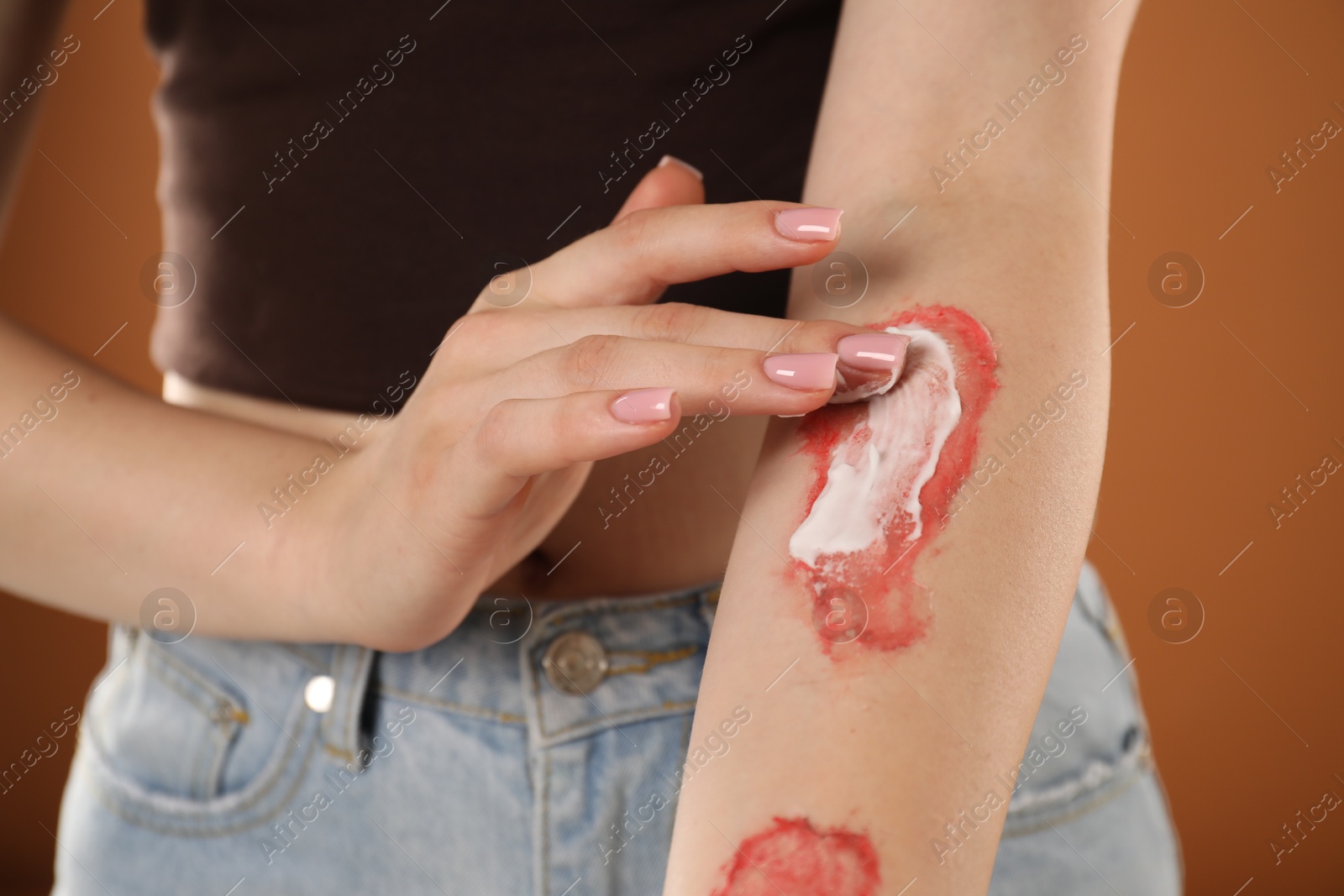 Woman applying healing cream onto burned hand on brown background, closeup Photo of Woman applying healing cream onto burned hand on brown background, closeup