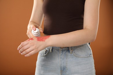 Photo of Woman applying healing cream onto burned hand on brown background, closeup