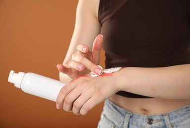 Photo of Woman applying healing cream onto burned hand on brown background, closeup