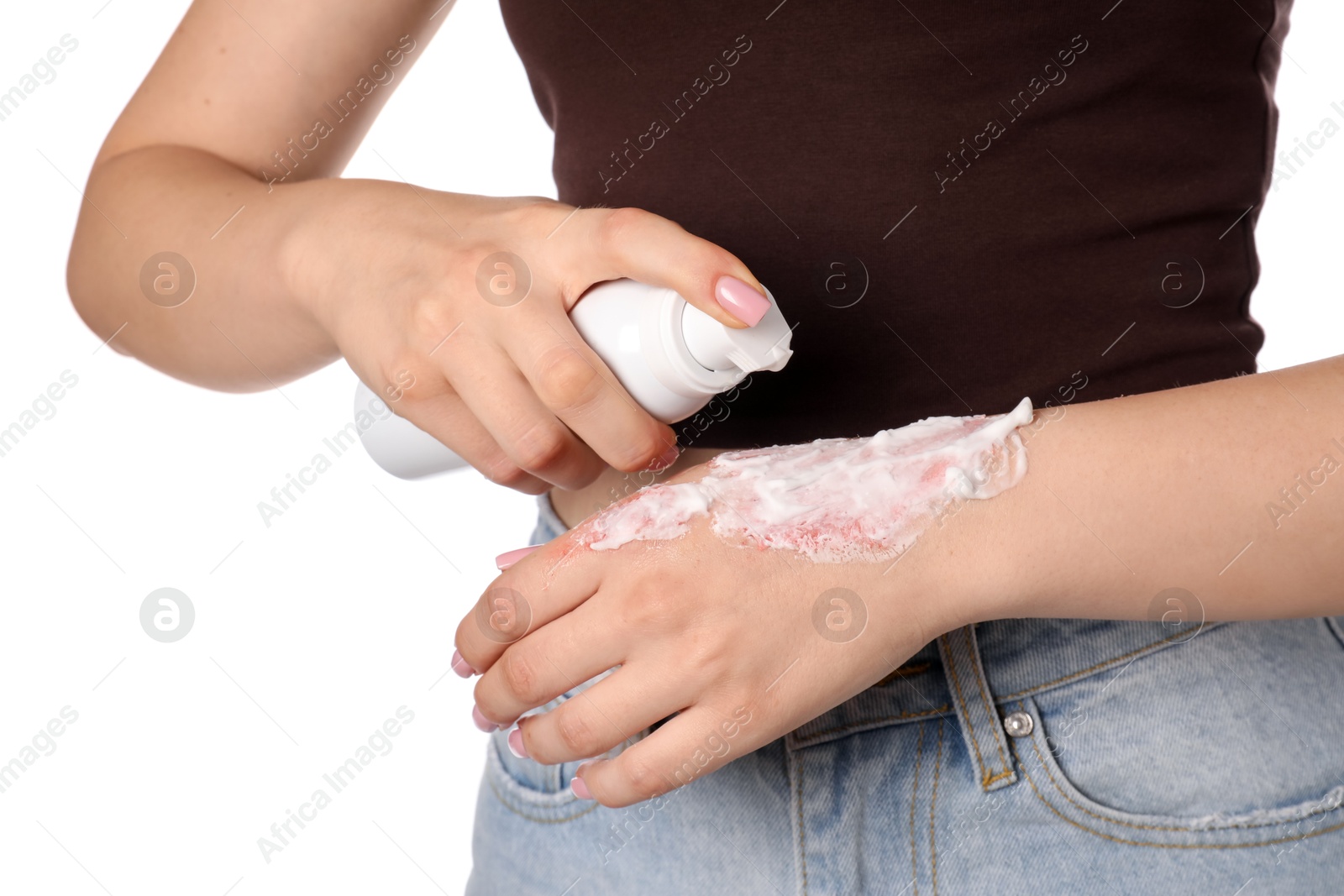Woman applying healing cream onto burned hand on white background, closeup Photo of Woman applying healing cream onto burned hand on white background, closeup
