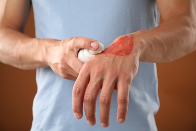 Photo of Man applying healing cream onto burned hand on brown background, closeup