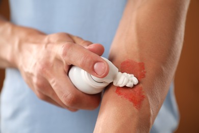 Photo of Man applying healing cream onto burned hand on brown background, closeup
