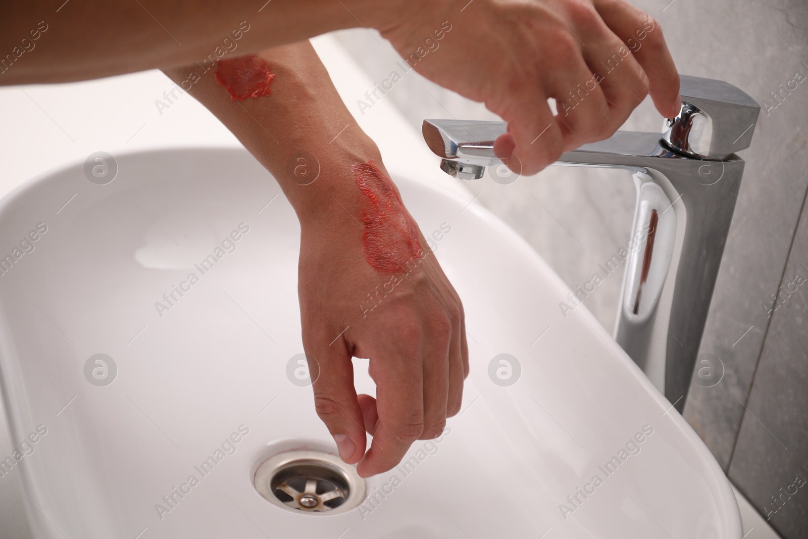 Photo of Man holding burned hand under water indoors, closeup