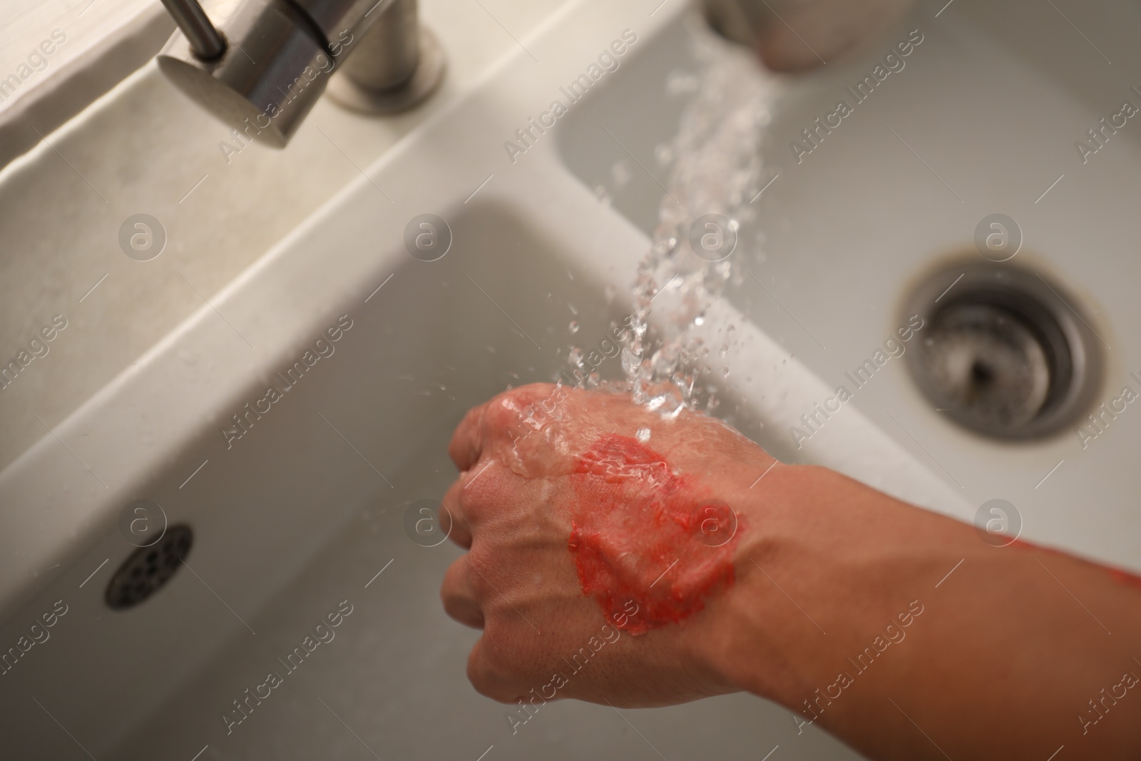 Photo of Man holding burned hand under water indoors, above view
